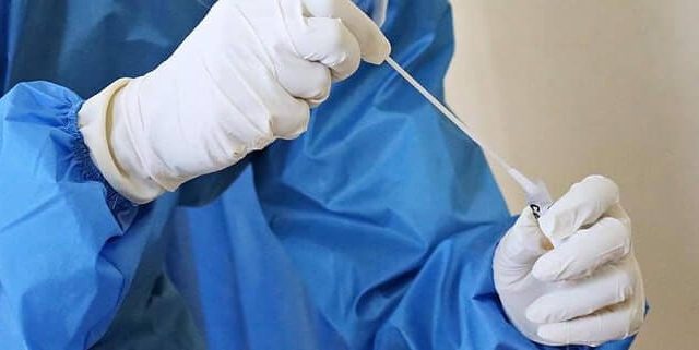 Σέρρες, σε αυτό το σημείο θα γίνουν αύριο 14/1 δωρεάν Rapid Test